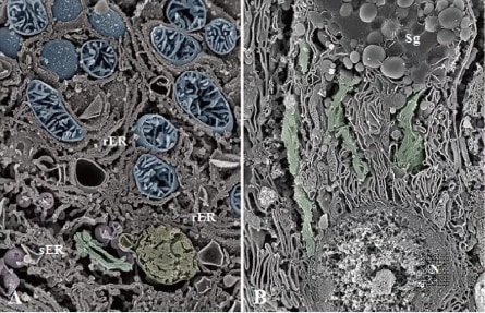 Example of an osmium-maceration SEM image THE HITACHI SCIENTIFIC INSTRUMENT NEWS Vol.7 (2016)
Serial-section scanning electron microscopy