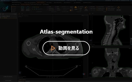 Atlas-segmentation