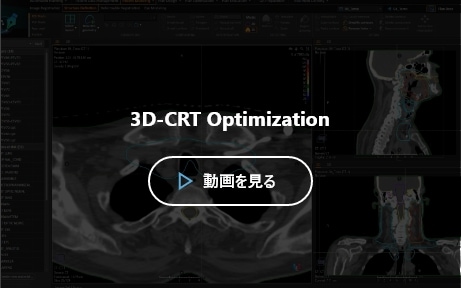 3D-CRT Optimization