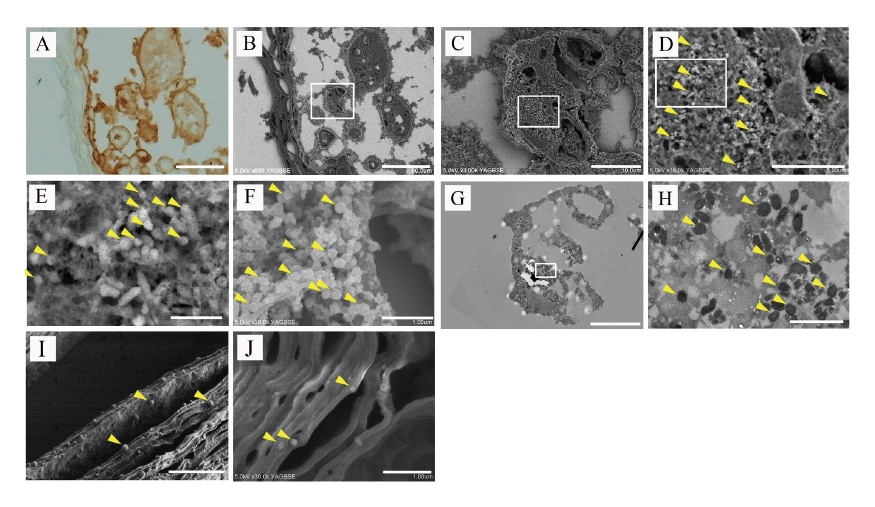 図3 Varicella-Zoster virus(VZV)の免疫染色CLEM像