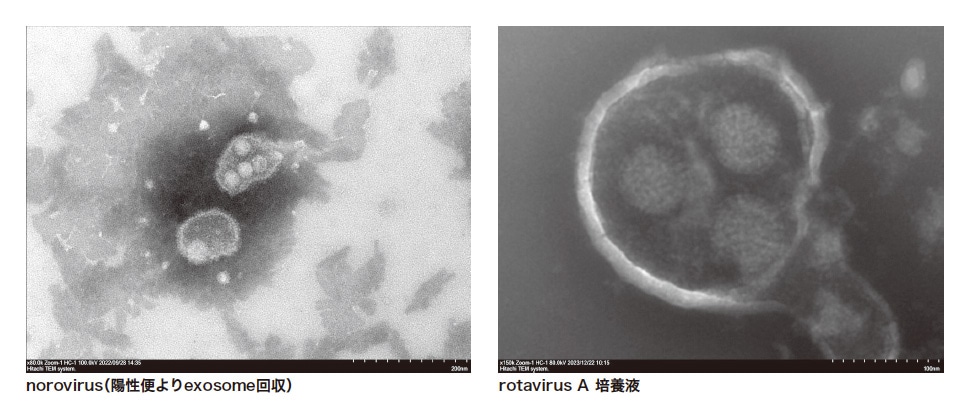 図5 Vesicleの観察