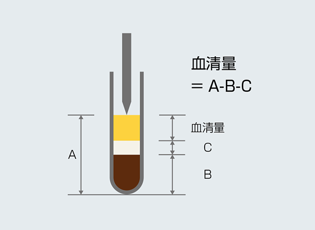 再検査・追加検査への迅速な対応